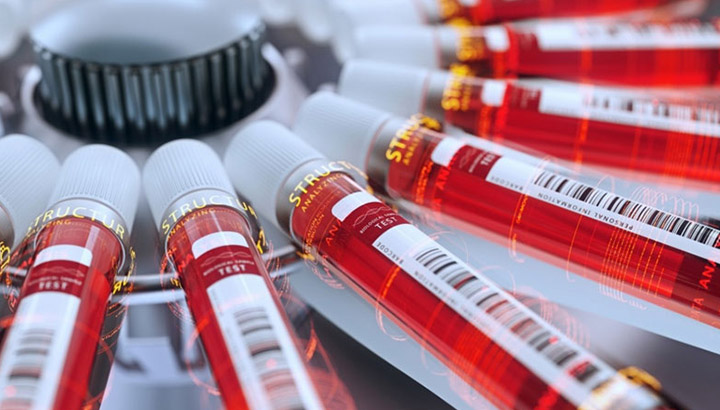 Aplicación De La centrifugación en la industria farmacéutica